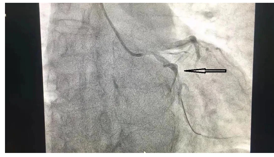 1647442348329580.png QQ截图20220316224629.png