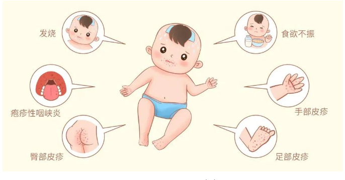 手足口病进入高发期，这份防控指南请收好！！