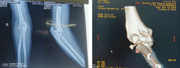 1653011384954444.png image.png