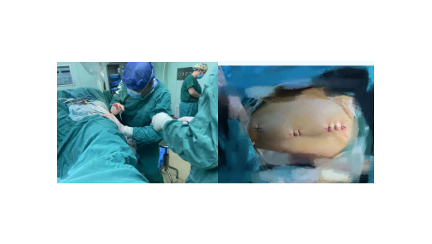 厉害了，我院成功救治一位98岁高龄骨折患者