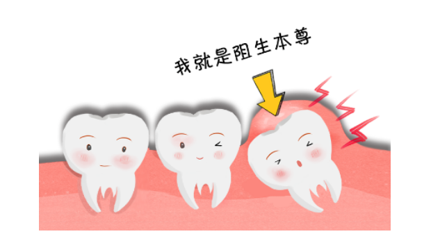 牙齿也会难产？这个关乎你颜值高低，一定要注意！