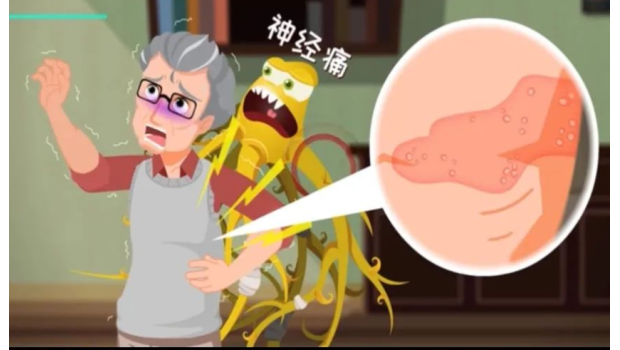 红斑、水疱，这种火辣辣的疼怎么治？