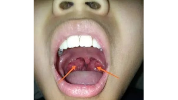 白天鹅变丑小鸭，谁的错？