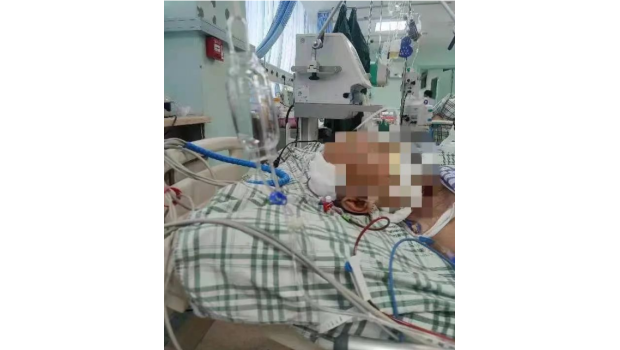 颅内血肿清干净,“软通道”才是硬实力！