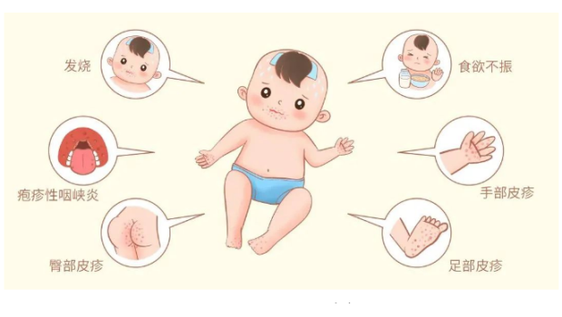 手足口病进入高发期，这份防控指南请收好！！